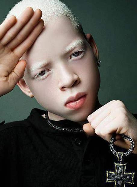 Meet Robdarius ‘Roben X’ Brown - People with albinism, by United