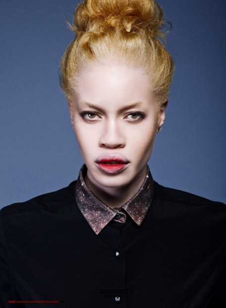 african albino model