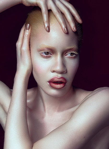 albino african american model